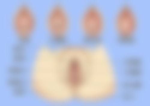 五、贵阳丽都医疗美容医院植发实例