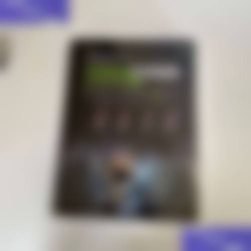 谢志军发际线植发实例