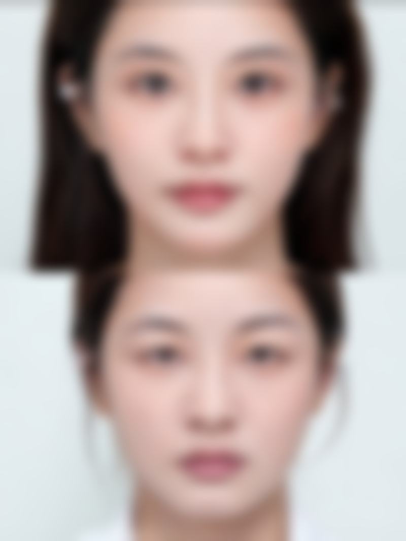 四、丽江美柏瑞医疗美容医院实例