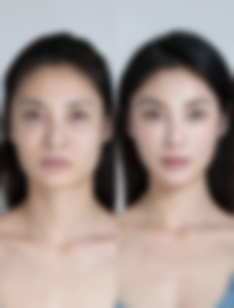 小孩脸被指甲抓伤留疤别愁！多阶段护理+专业医美，有效消除疤痕焕新颜 