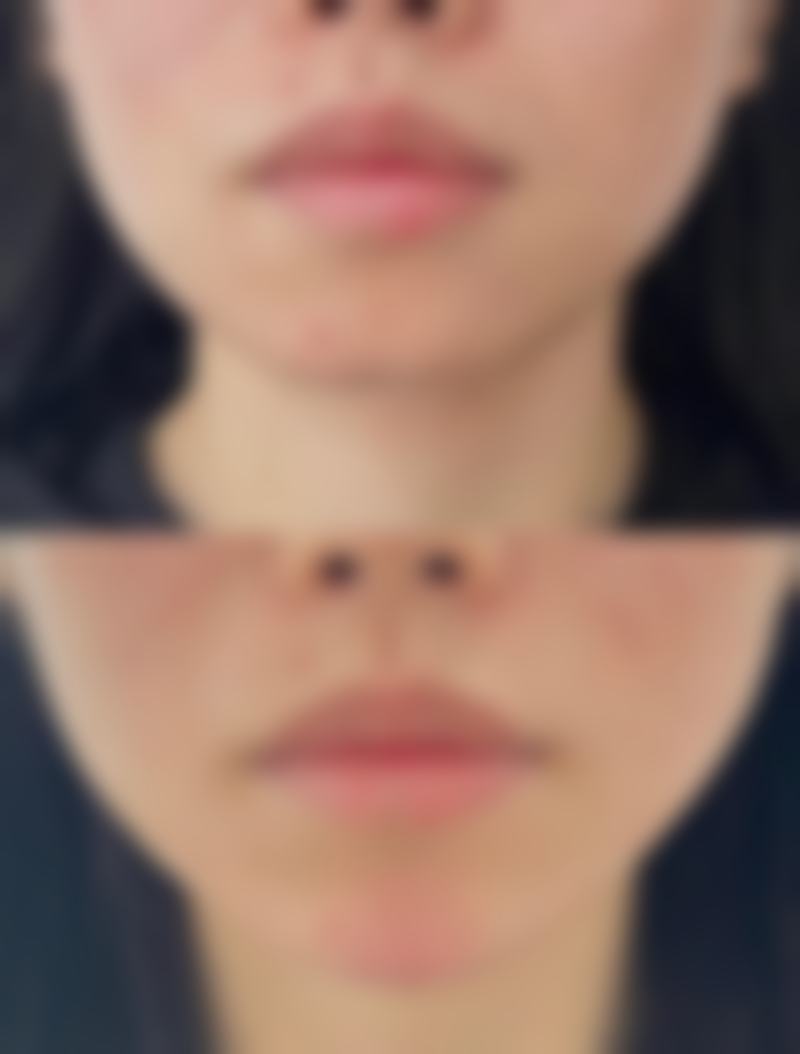 六、内蒙古包头伽蓝(原巴诺巴奇)医疗美容门诊部怎么预约: