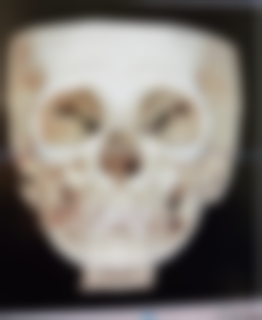 五、济南雍禾植发医疗美容诊所怎么预约：