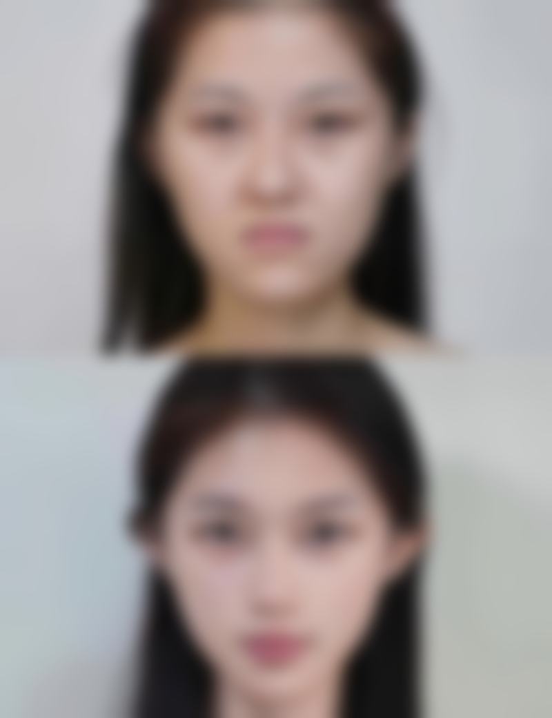 五、广州紫馨医疗美容门诊部怎么预约：