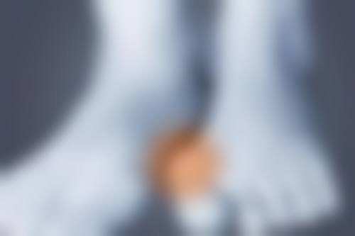 还你平滑脸蛋！脸上旧凹陷疤痕修复攻略，多种方案定制专属美肌