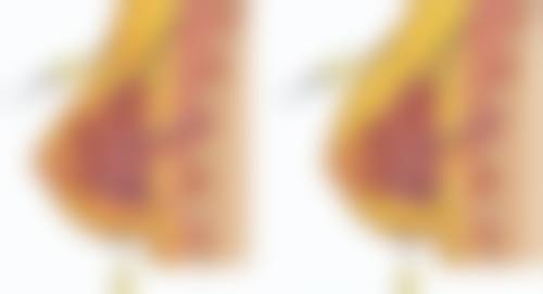 夏天割眼袋可行吗？科学护理保护修复