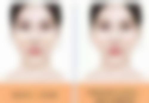 摔伤疤痕色素沉着能祛除！早期护理特别重要