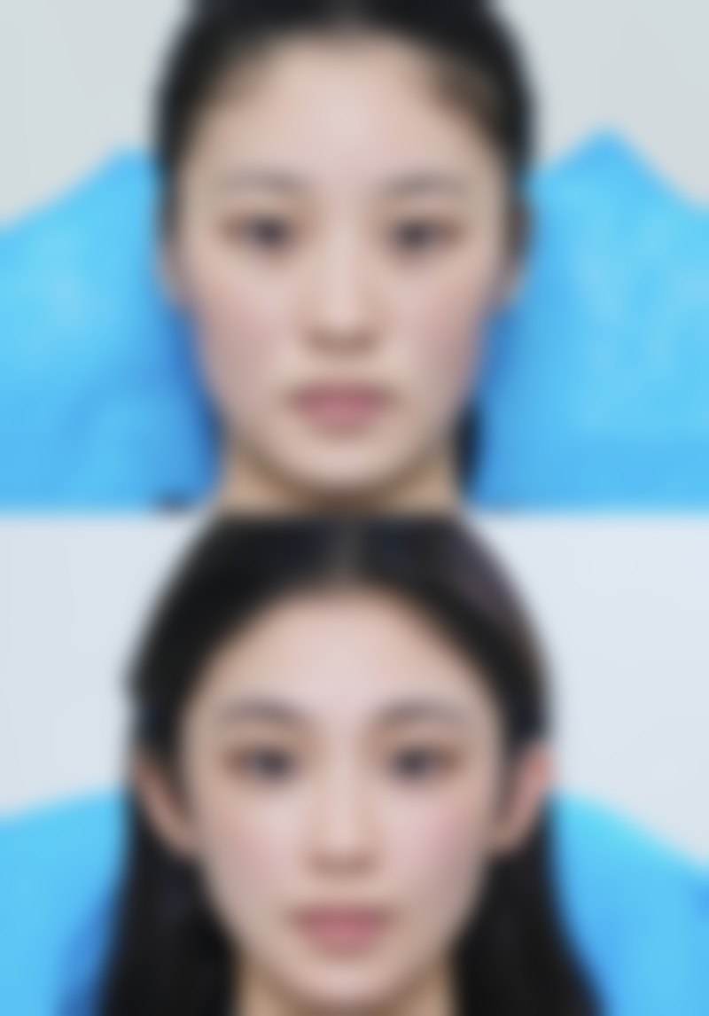 八、重庆联合丽格美容整形医院真实的顾客评价如下：