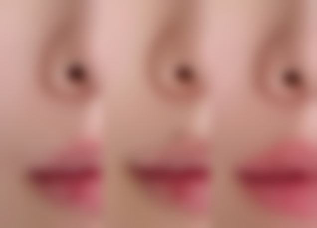 还你平滑脸蛋！常见修复方案大揭秘