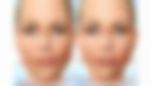 六、贵阳美目医疗美容诊所价格表:(仅供参考)