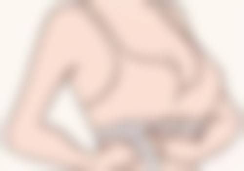 心脏不好做眼袋手术,术后修复要注意啥?