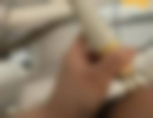 影响大腿吸脂消肿速度的因素