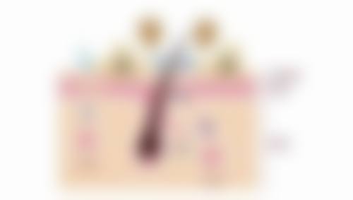 术后保养:延长成效的秘诀