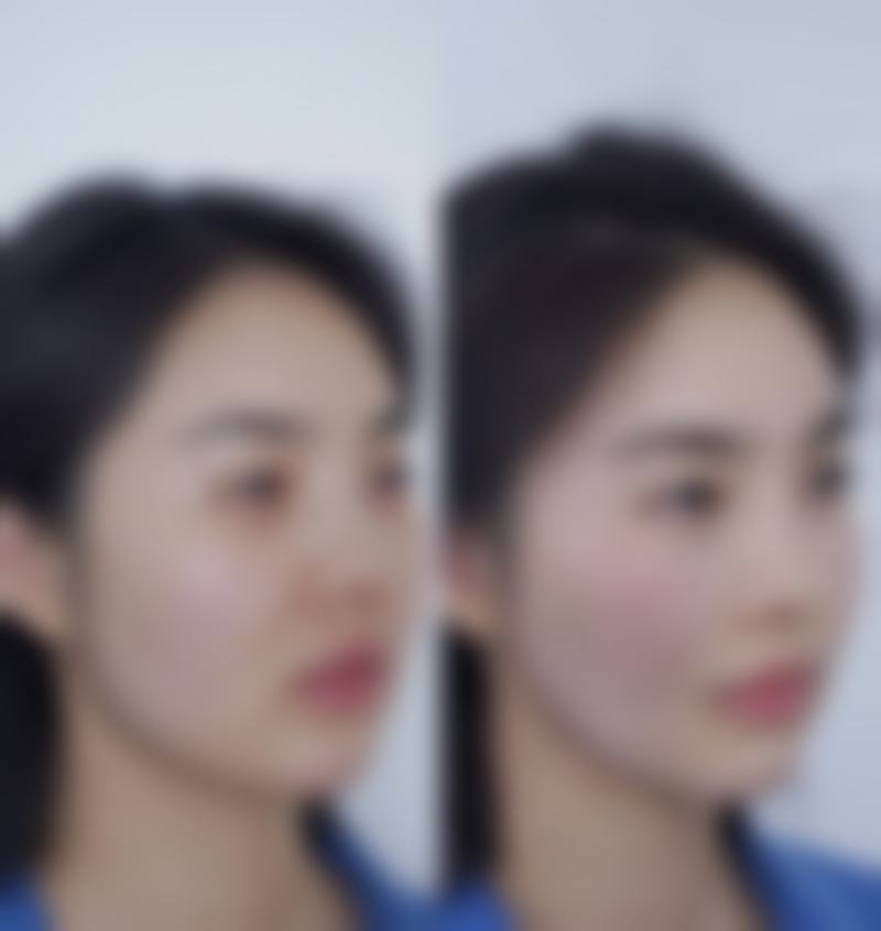 七、深圳盛美佳医疗美容整形医院真实的顾客评价如下：