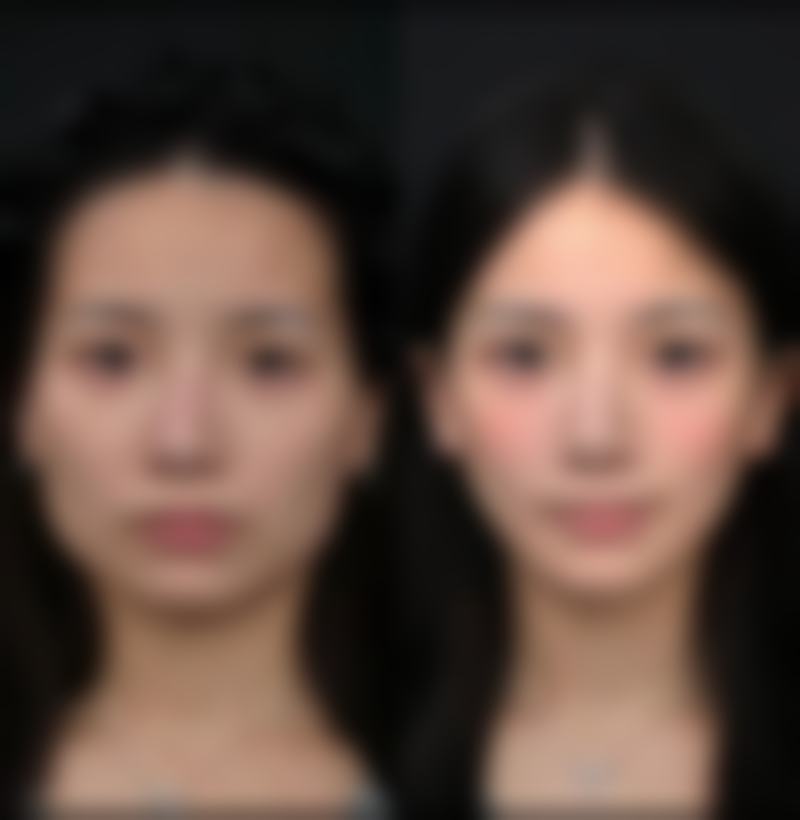 五、泸州韩美整形门诊部怎么预约：