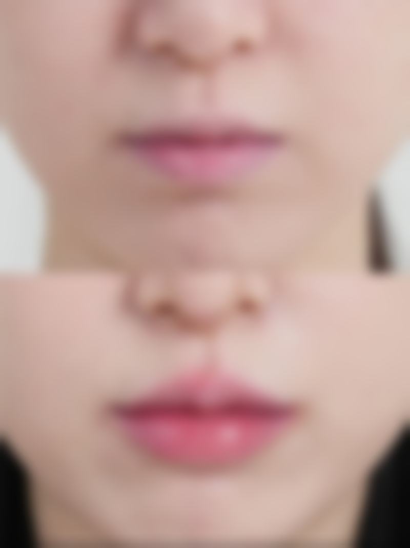 六、高碑店市燕赵大街惠美烧伤整形外科诊所怎么预约：