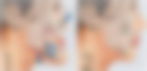 五、重庆华肤皮肤病医院实例