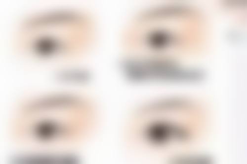 玻尿酸注射除皱成效棒？安心性有保护！