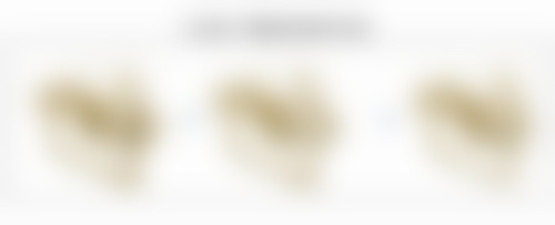 五、济南优仙整形医院实例：