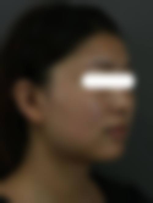 付崇华面部整形手术项目价格表参考