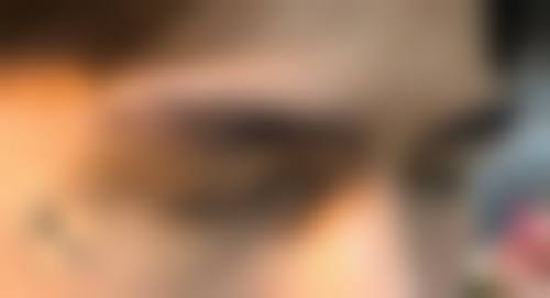 金铮治疗白癜风水平怎么样可靠吗?