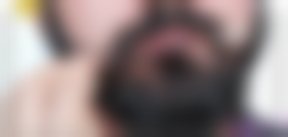 金铮治疗白癜风实例