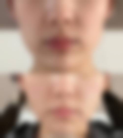 付崇华面部整形手术水平怎么样可靠吗?