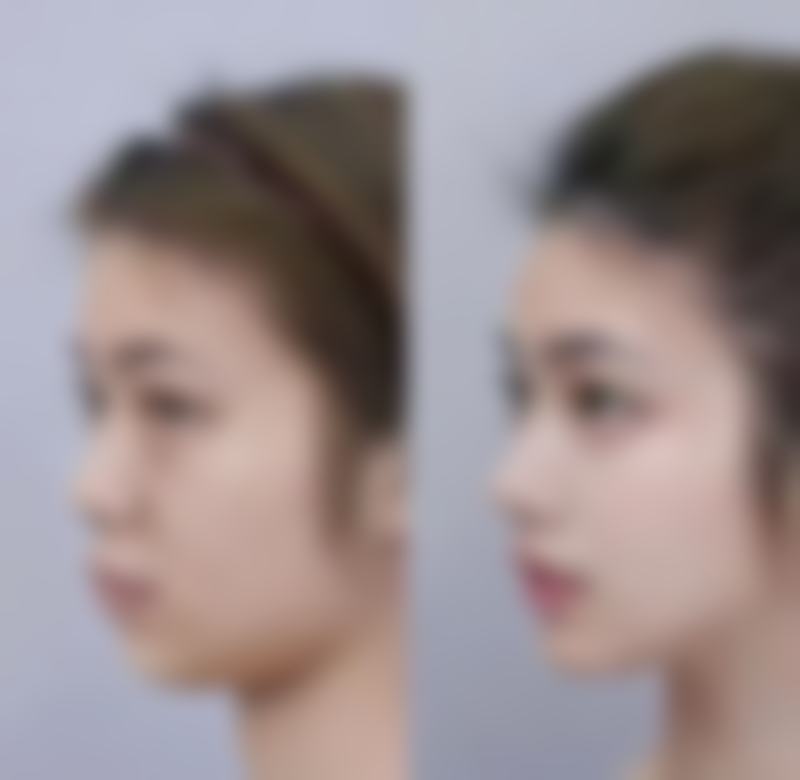 正规医院医美改善方案之日常护理建议