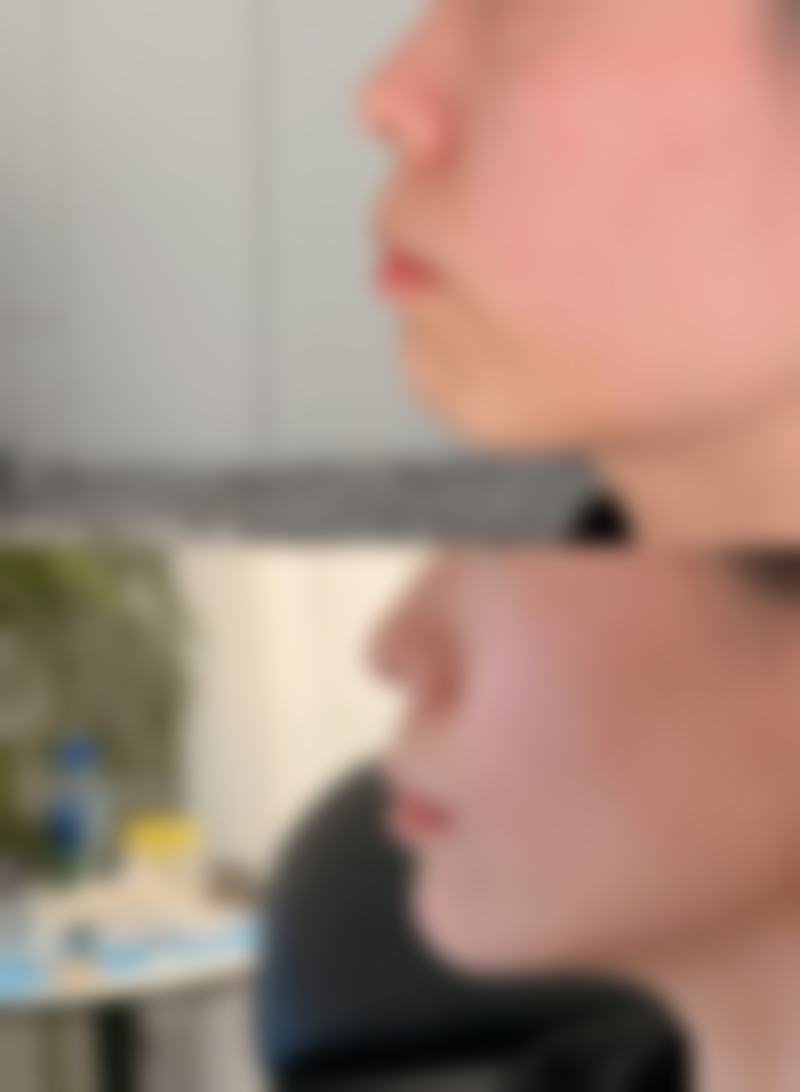 四、济南优仙整形医院开展的主要项目和特色项目：