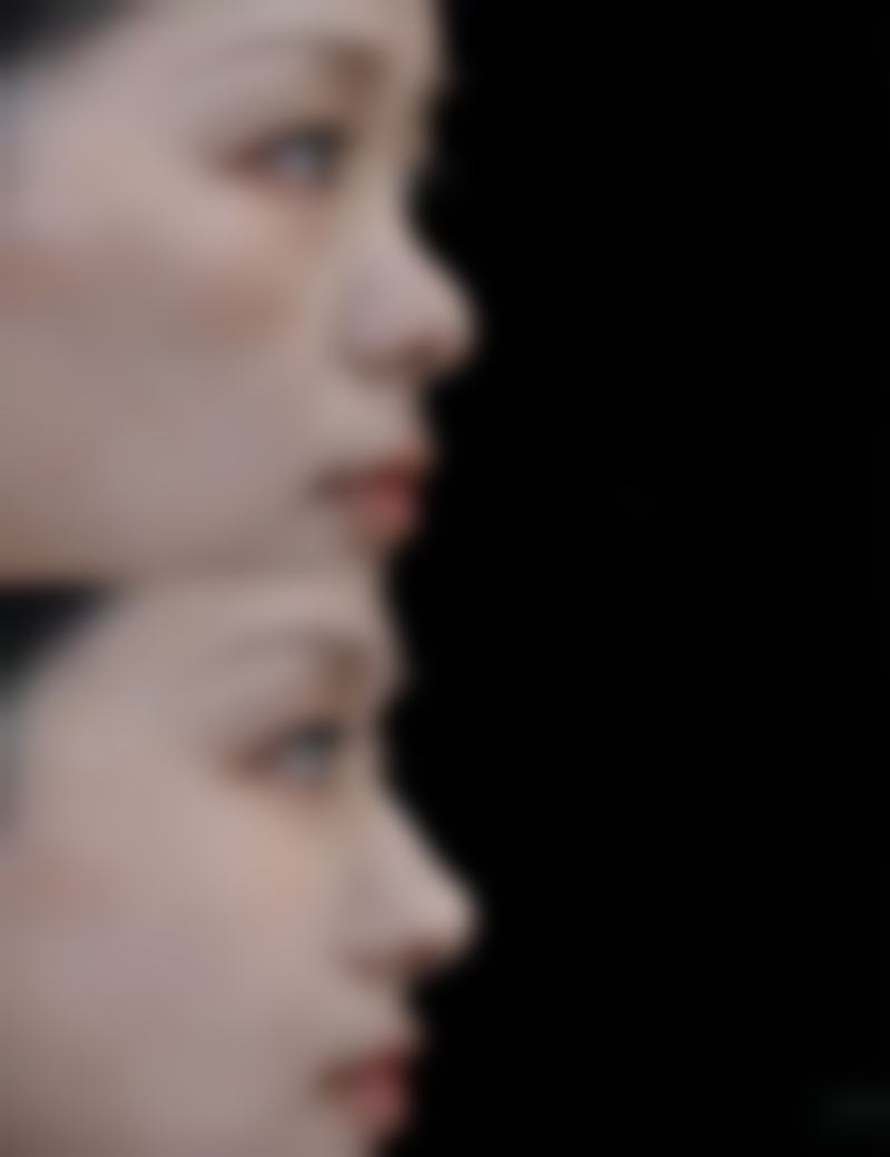 陈秀芸面部轮廓整形水平怎么样可靠吗?