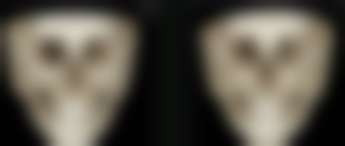 眼袋贴能否去除眼袋？揭秘其改善浮肿眼袋外观的原理与科学应对方案 