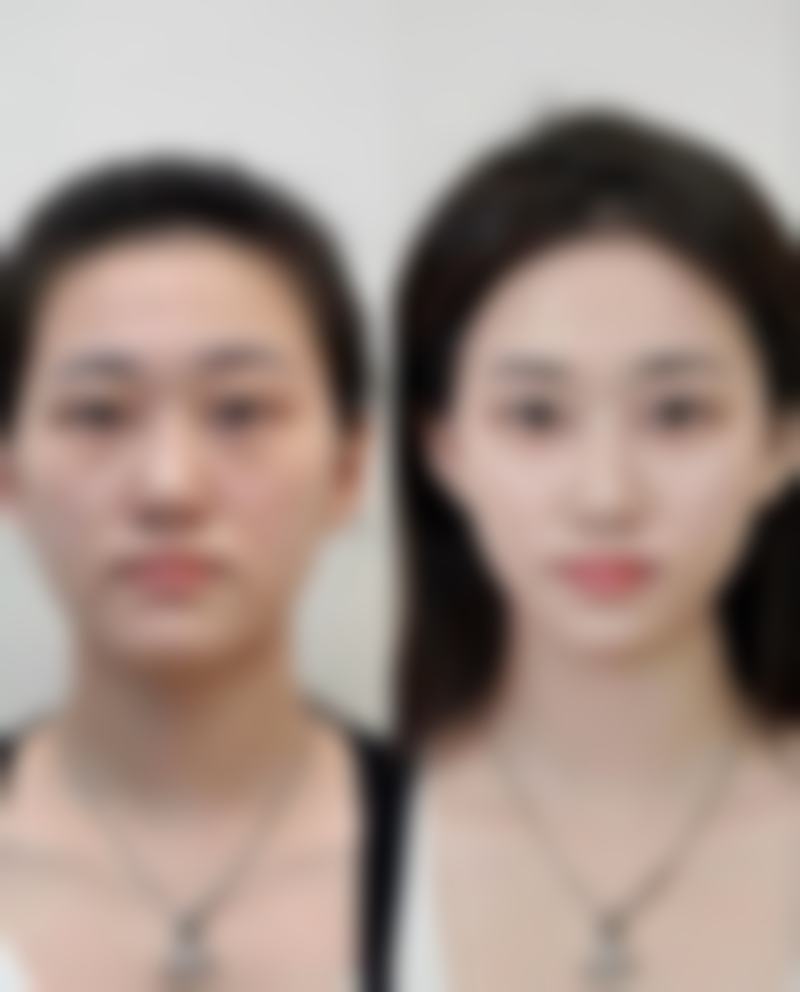 六、重庆华肤皮肤病医院怎么预约：