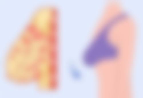 安心泡温泉助力抽脂成效与皮肤健康