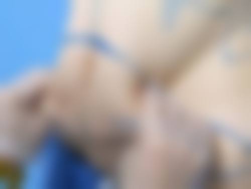 选择正规医院，保护激光祛疤成效