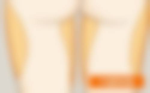 五、武汉民生五官医院整形科实例