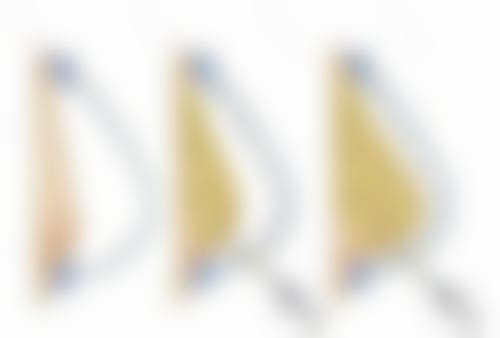 割双眼皮成功几率究竟几何？选择靠谱医院是保护