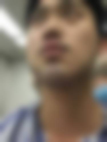 金铮治疗白癜风实例