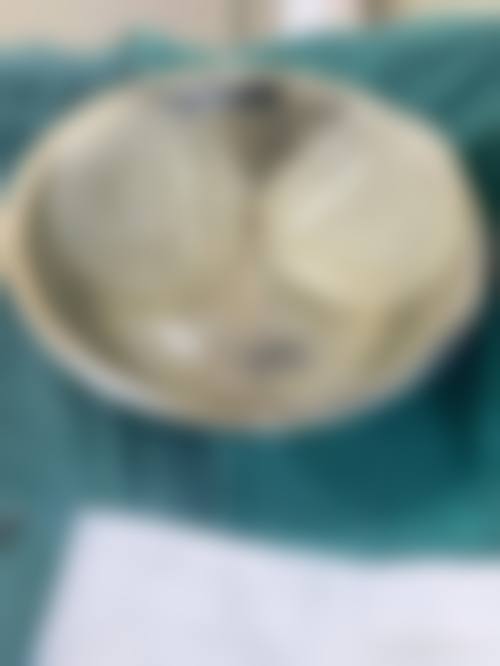 付崇华面部整形手术水平怎么样可靠吗？