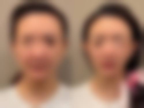 陈秀芸项目价格表参考