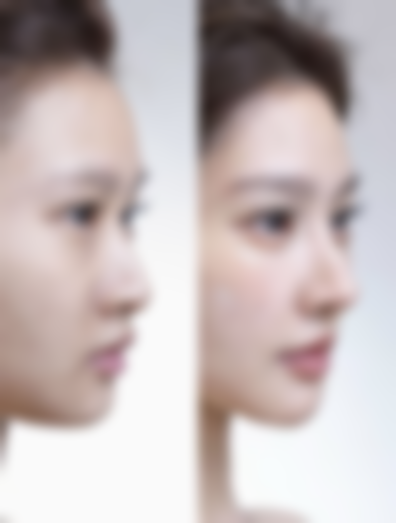 必知注意点：谨慎选择药物，确保合规安心