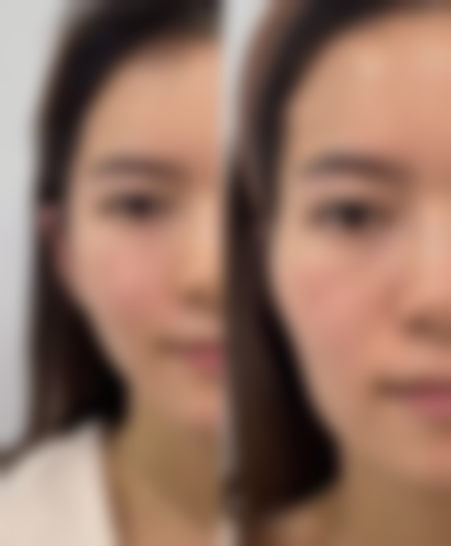 七、东莞佰佳整形价格表：（仅供参考）