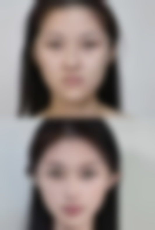 日常护理小妙招,轻松赶走眼袋