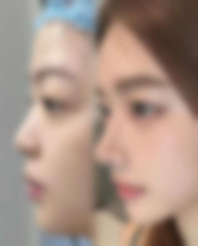 杨宏洲面部轮廓塑造实例