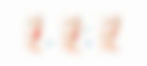 结语：埋线双眼皮后常睁大眼睛好处多，助力惊艳修复！