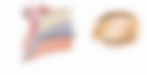 窦兴斌眼部整形实例