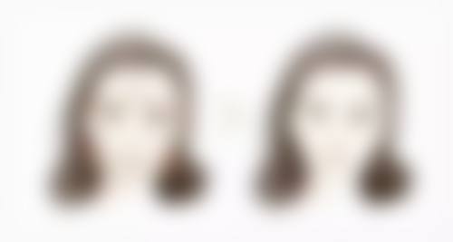 四、三亚吉阳耀容貌整形医院实例