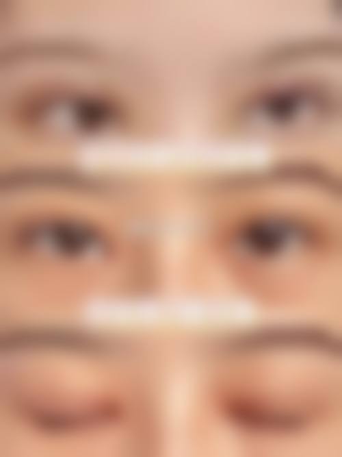 王文科眼部整形水平怎么样可靠吗?