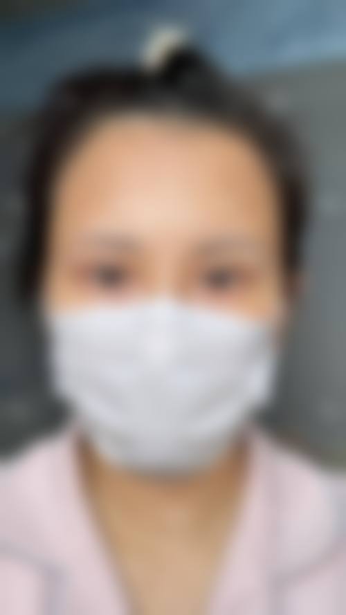 窦兴斌眼部整形项目价格表参考