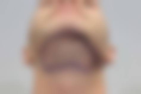 金铮怎么预约？