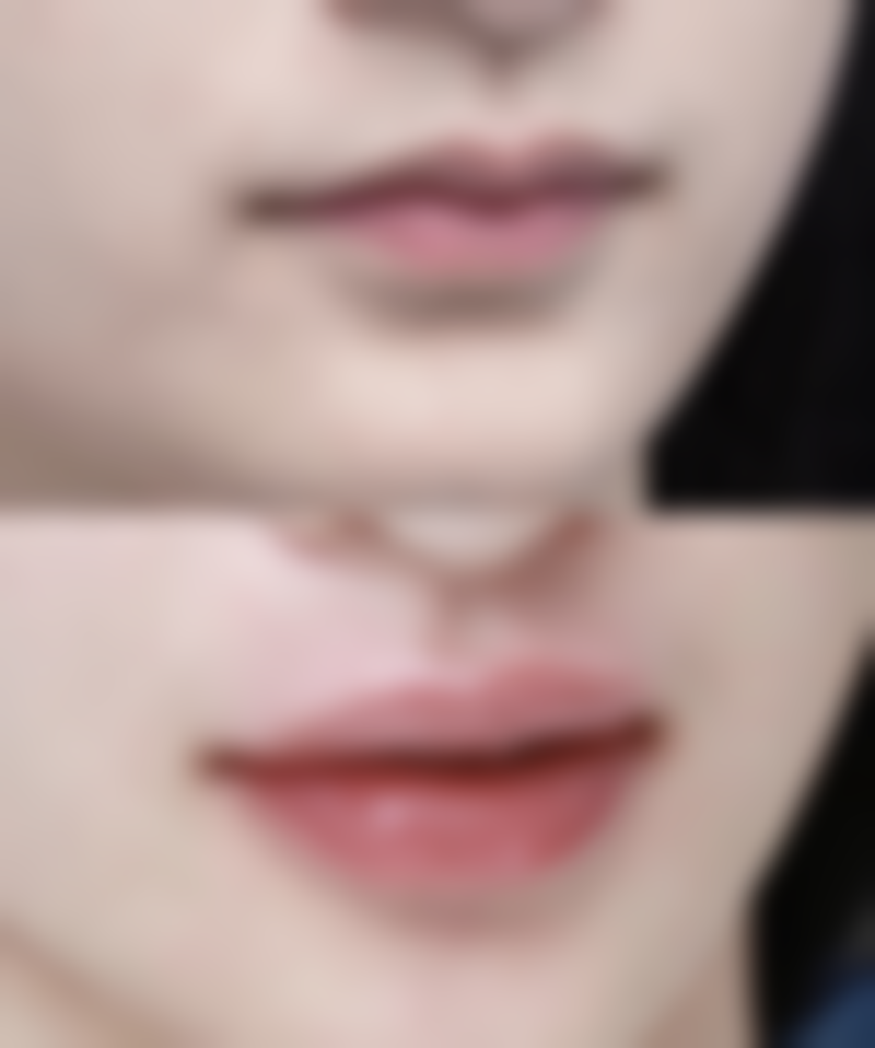 头发种植到底好不好？自然持久、微创安全，助你改善外观重拾自信！ 