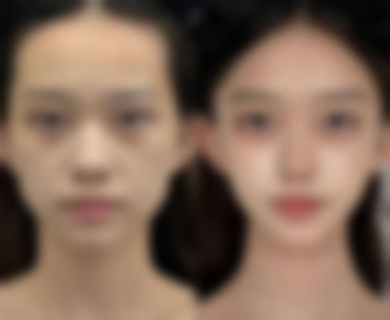 黑眼圈眼袋愈发重度？日常注意事项助力改善